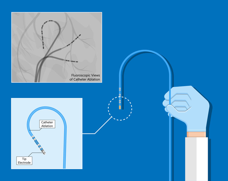Treatments at Cardiac Centre International